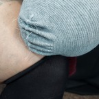 notoesnoleftleg (QueenUniPed) OnlyFans Leaked Pictures & Videos 

 profile picture