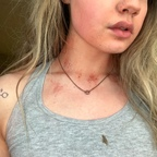 sydney_spiderz (Sydney Spiderz) free OnlyFans Leaked Pictures and Videos 

 profile picture